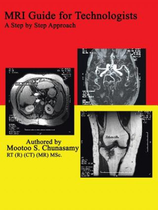 Книга Mri Guide for Technologists: A Step by Step Approach Mootoo S Chunasamy