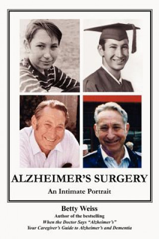 Könyv Alzheimer's Surgery Weiss