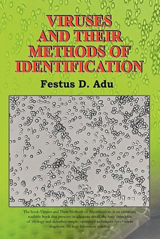 Carte Viruses and Their Methods of Identification Festus D. Adu