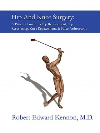 Könyv Hip And Knee Surgery: A Patient's Guide To Hip Replacement, Hip Resurfacing, Knee Replacement, And Knee Arthroscopy Robert Kennon