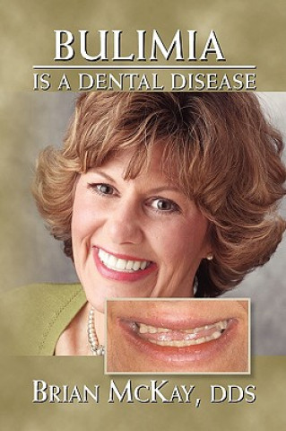 Buch Bulimia Is a Dental Disease Brian Dds McKay