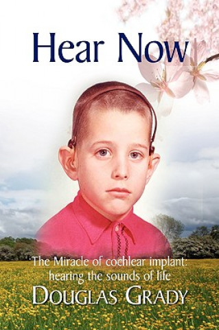 Livre Hear Now Douglas Grady