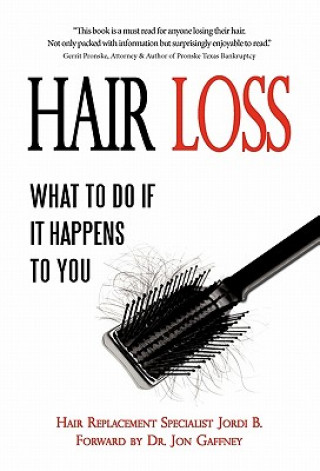 Kniha Hair Loss Jordi B