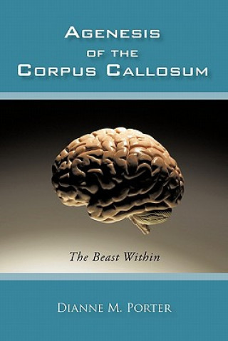 Kniha Agenesis of the Corpus Callosum Dianne M Porter