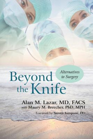 Könyv Beyond the Knife Alan M Lazar MD Facs