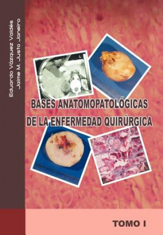 Książka Bases Anatomopatologicas de La Enfermedad Quirurgica Eduardo Vazquez V