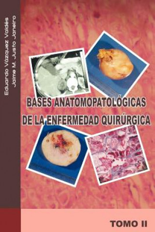 Libro Bases Anatomopatologicas de La Enfermedad Quirurgica Eduardo Vazquez