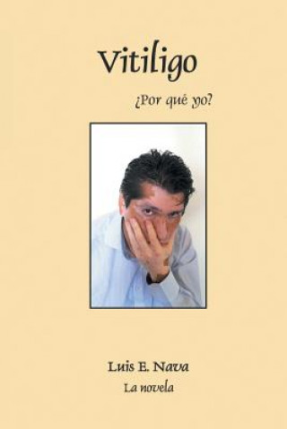 Книга Vitiligo Luis Enrique Nava Martinez
