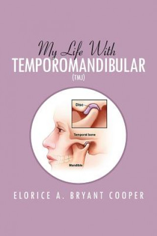 Kniha My Life with Temporomandibular (Tmj) Elorice A Bryant Cooper