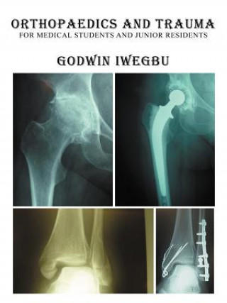 Carte Orthopaedics and Trauma for Medical Students and Junior Residents Godwin Iwegbu