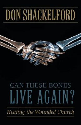 Buch Can These Bones Live Again? Don Shackelford