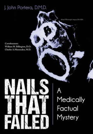 Book Nails That Failed J John Portera D M D