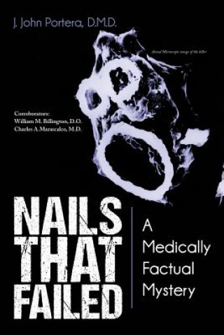 Kniha Nails That Failed J John Portera D M D