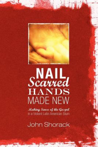 Carte Nail Scarred Hands Made New John Shorack