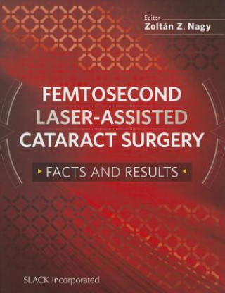 Carte Femtosecond Laser-Assisted Cataract Surgery Zoltan Z. Nagy