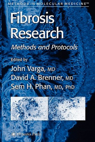 Book Fibrosis Research John Varga