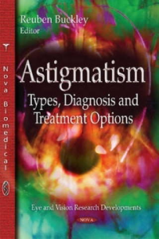 Livre Astigmatism REUBEN BUCKLEY