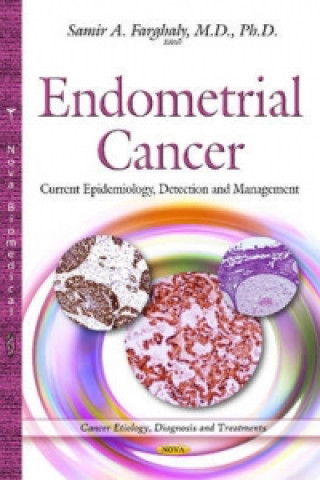 Könyv Endometrial Cancer SAMIR A FARGHALY