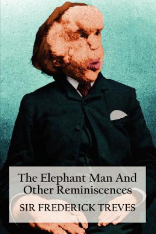 Könyv Elephant Man And Other Reminiscences Sir Frederick Treves