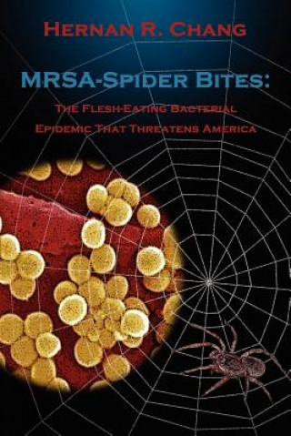 Livre MRSA - Spider Bites: The Flesh-Eating Bacterial Epidemic That Threatens America Hernan R. Chang