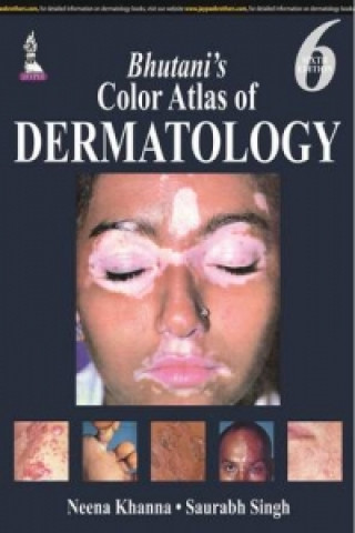 Książka Bhutani's  Color Atlas of Dermatology Neena Khanna