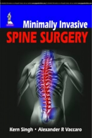 Kniha Minimally Invasive Spine Surgery Kern Singh
