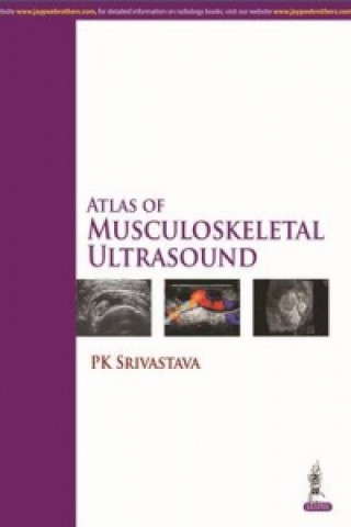 Carte Atlas of Musculoskeletal Ultrasound PK Srivastava