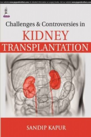 Könyv Challenges and Controversies in Kidney Transplantation Sandip Kapur
