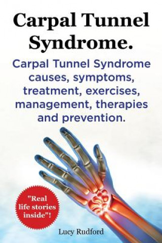Carte Carpal Tunnel Syndrome, Cts. Carpal Tunnel Syndrome Cts Causes, Symptoms, Treatment, Exercises, Management, Therapies and Prevention. Lucy Rudford