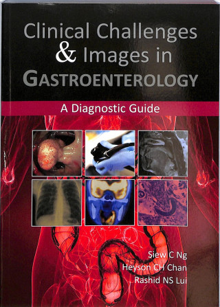 Kniha Clinical Challenges & Images in Gastroenterology Lui