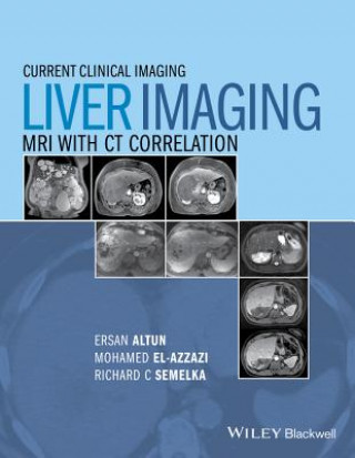 Kniha Liver Imaging - MRI with CT Correlation Ersan Altun