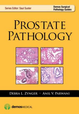Carte Prostate Pathology Anil V. Parwani
