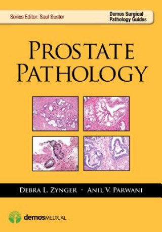 Книга Prostate Pathology Anil V. Parwani