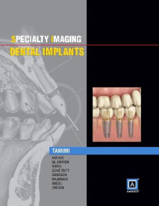 Könyv Specialty Imaging: Dental Implants Dania Faisal Tamimi