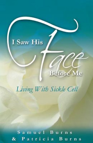 Kniha I Saw His Face Before Me - Living with Sickle Cell Anemia Patricia a Burns