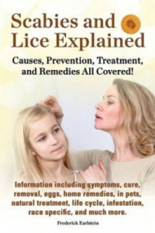 Carte Scabies and Lice Explained. Causes, Prevention, Treatment, and Remedies All Covered! Information Including Symptoms, Removal, Eggs, Home Remedies, in Frederick Earlstein