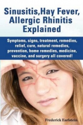 Könyv Sinusitis, Hay Fever, Allergic Rhinitis Explained. Symptoms, Signs, Treatment, Remedies, Relief, Cure, Natural Remedies, Prevention, Home Remedies, Me Frederick Earlstein