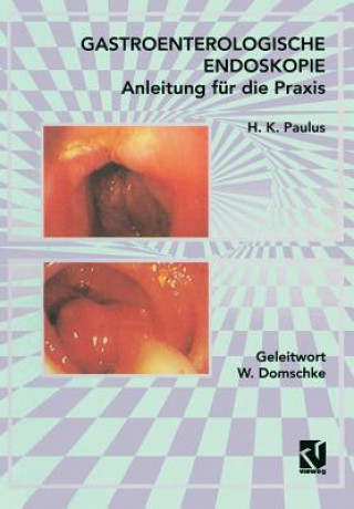 Könyv Gastroenterologische Endoskopie Anleitung Fur Die Praxis H K Paulus