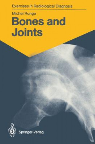 Carte Bones and Joints Michel Runge