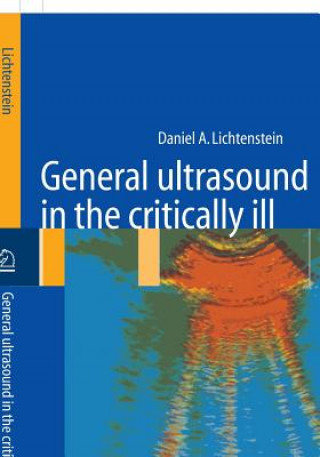 Carte General ultrasound in the critically ill Daniel A. Lichtenstein