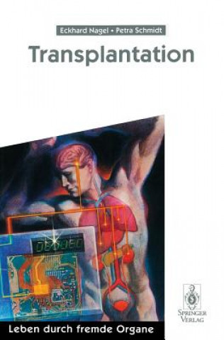 Könyv Transplantation G Wolfslast