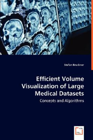 Kniha Efficient Volume Visualization of Large Medical Datasets - Concepts and Algorithms Stefan Bruckner