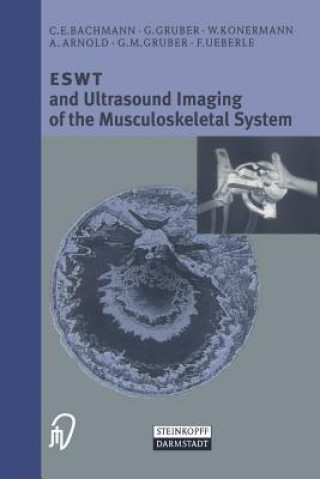 Knjiga ESWT and Ultrasound Imaging of the Musculoskeletal System F. Ueberle