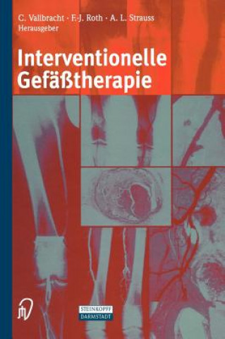 Carte Interventionelle Gefasstherapie Christian Vallbracht