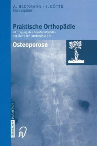 Kniha Osteoporose ACHIM HEDTMANN