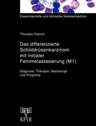 Könyv differenzierte Schilddrusenkarzinom mit initialer Fernmetastasierung (M1) Thorsten Petrich