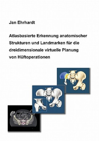 Carte Atlasbasierte Erkennung anatomischer Strukturen und Landmarken fur die dreidimensionale virtuelle Planung von Huftoperationen Jan Ehrhardt