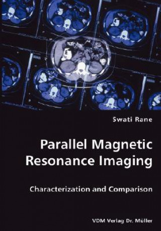 Book Parallel Magnetic Resonance Imaging Swati Rane