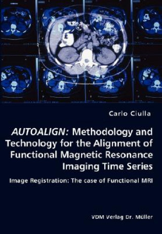 Knjiga Autoalign Ciulla