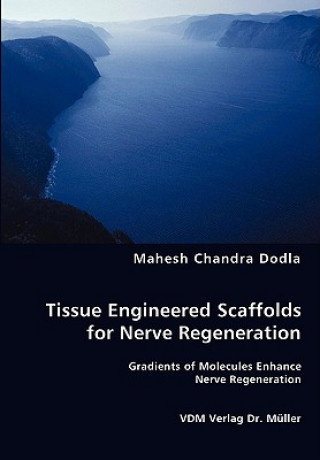 Carte Tissue Engineered Scaffolds for Nerve Regeneration Mahesh Chandra Dodla